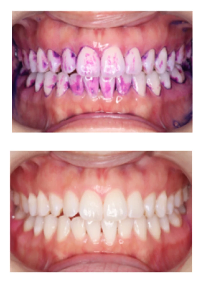 エアフローについて